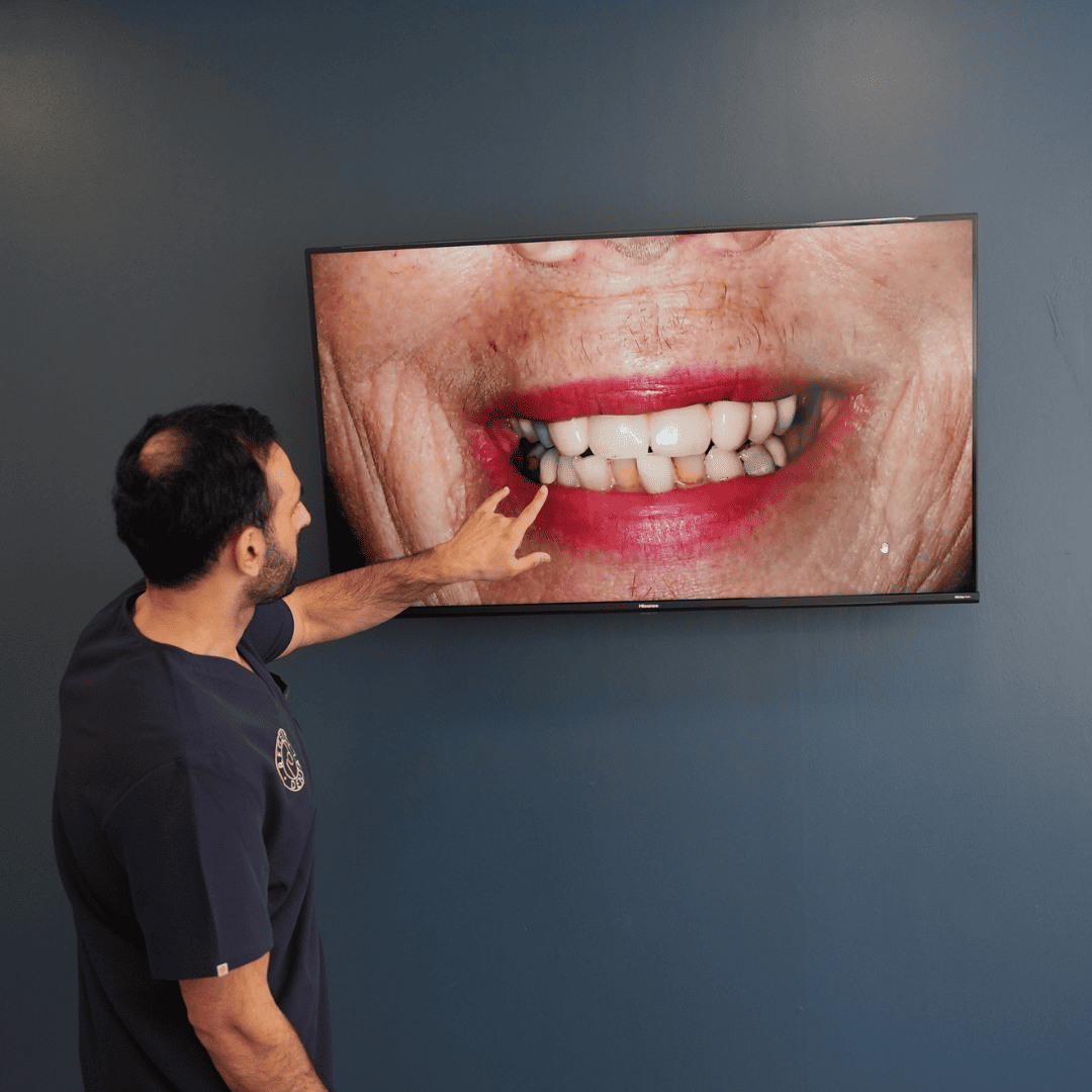 Gum Health: The Foundation Of Every Beautiful Smile